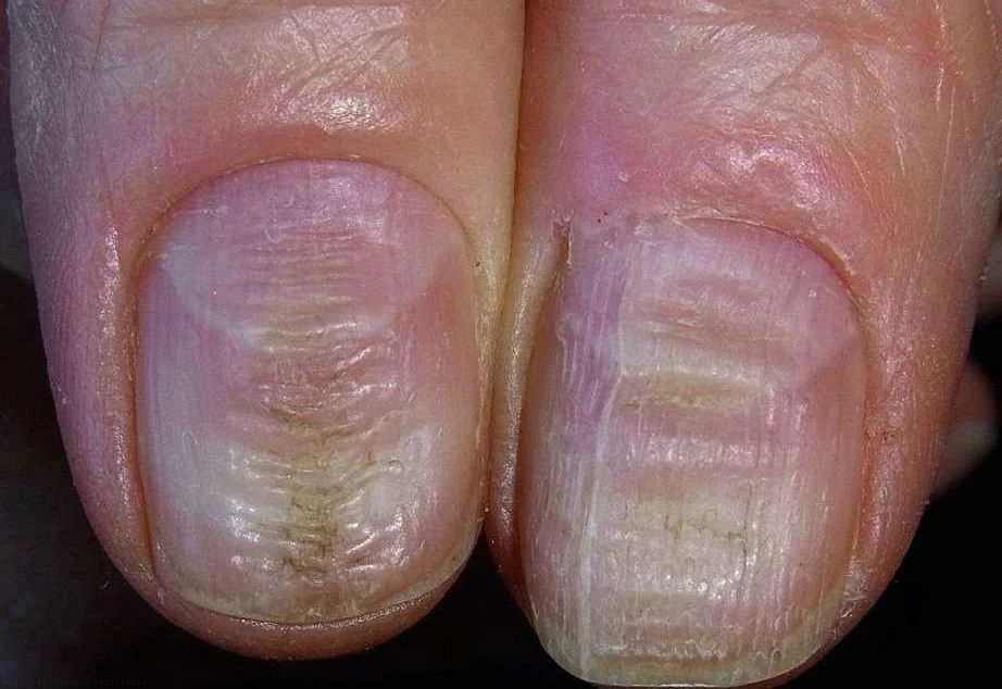 7 признаков здоровых ногтей: как их обнаружить и сохранить