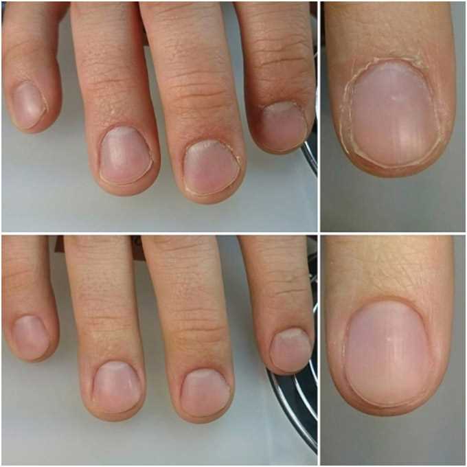 Аппаратный маникюр: как поддерживать результаты процедуры