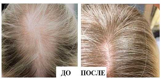 Этап третий: тщательное расчесывание