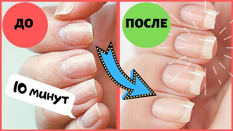 Укрепление ногтевой пластины
