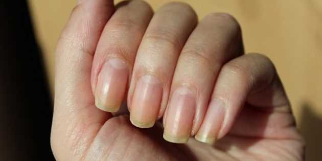 Как избежать желтизны ногтей и сохранить их естественный цвет