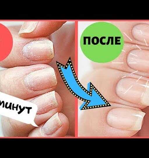Предотвращение проблем и травм при обрезании ногтей