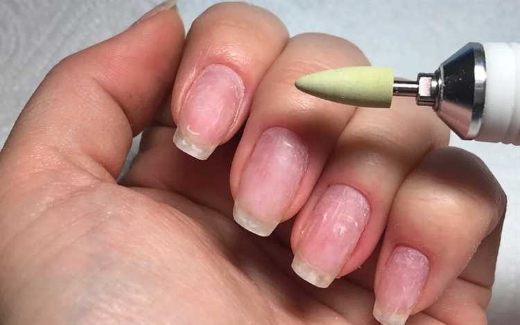 Трещины и секущиеся ногти