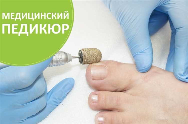 Проблемы кожи стопы и как их устранить с помощью лечебного педикюра