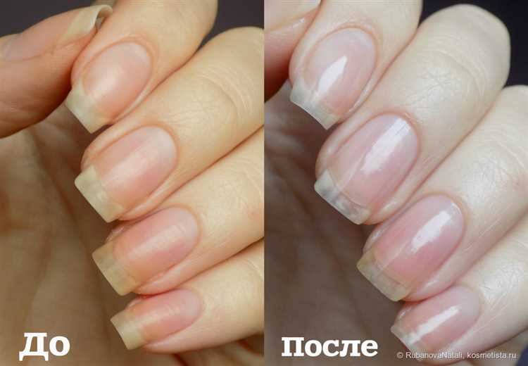 Маникюр для жаркого сезона: наша спасительная программа