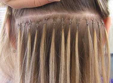 Разработки в области микроимплантации волос