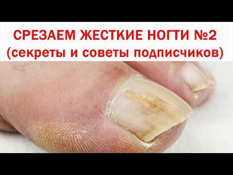 Ополаскивания для ногтей: 4 самых эффективных рецепта