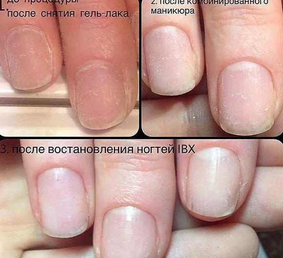Витаминные комплексы для укрепления