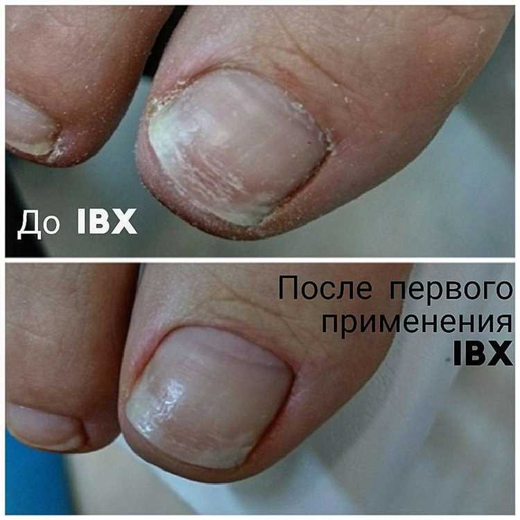 Регулярный массаж и укрепление ногтевой пластины