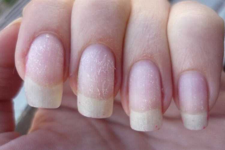 Важные правила по уходу за ногтями после нанесения гель-лака